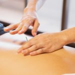 therapist pricking skin with needles during treatment procedure