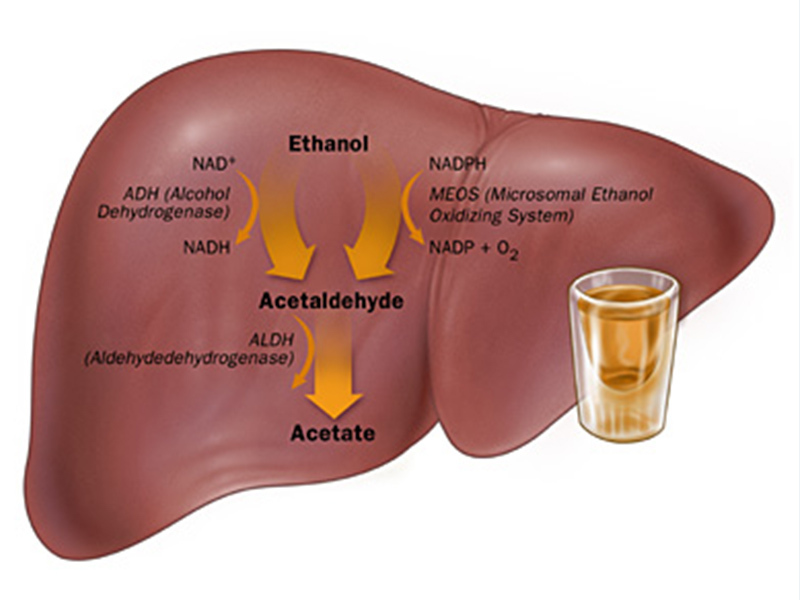 Alcohol Related Liver Disease