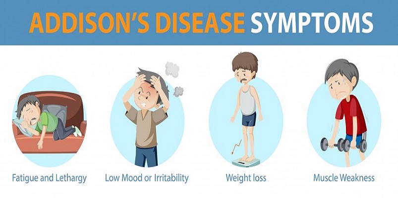 Addison’s Disease