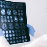 a doctor holding an mri result of the brain